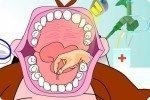 Arracher les dents Arracher les dents
